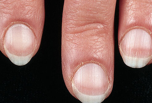 What Do Your Nails Say About Your Health? – Diet Sage